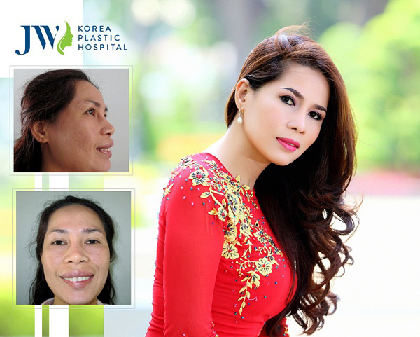 Lộ diện 10 gương mặt tại đại hội vinh danh người đẹp thẩm mỹ JW - 3