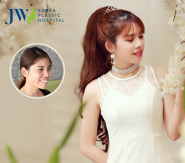 Lộ diện 10 gương mặt tại đại hội vinh danh người đẹp thẩm mỹ JW - 6