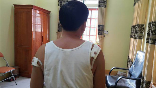 Vụ bắn chủ tịch xã: Hồ sơ trưởng công an xã "quên" án tích - 2