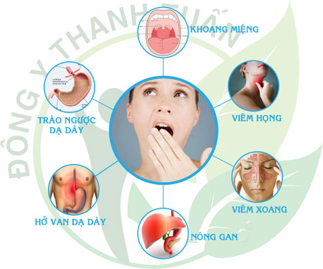 Bạn trẻ hôi miệng, phải làm sao? - 2