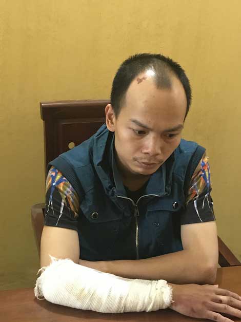 Cái kết đắng của kẻ cuồng yêu - 3