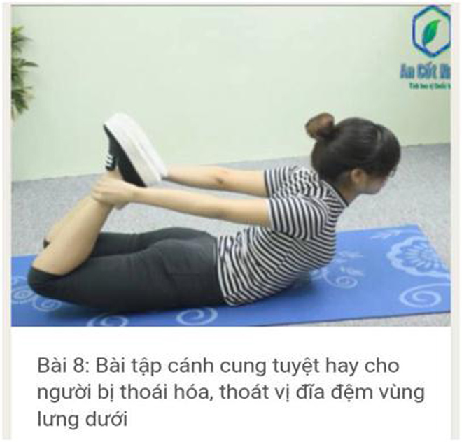 Thoát vị đĩa đệm là gì? Nguyên nhân, phương pháp chữa bệnh - 5