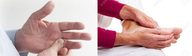 Tê bì chân tay như kim châm do tiểu đường: Đừng chủ quan, nguy cơ dẫn đến tàn phế - 1