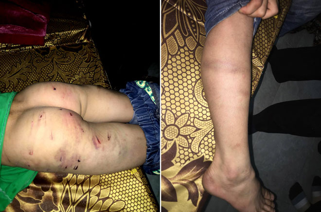 Quyết định bất ngờ của mẹ bé trai 9 tuổi bị bố đánh chi chít sẹo - 2