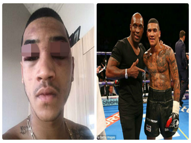 ”Độc cô cầu bại” boxing: Bị đấm sưng mặt, lên mạng ”mít ướt”