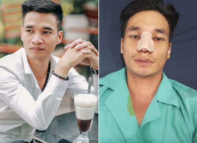 Lệ Rơi và những lần khiến dân mạng sốc năm 2017 - 3