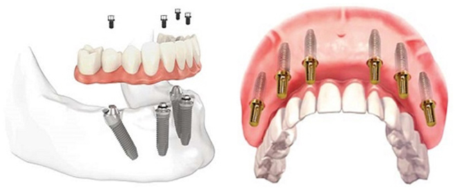 Nữ Việt kiều Mỹ: “Hàm răng của tôi đáng giá hơn chiếc xe hơi” - 5