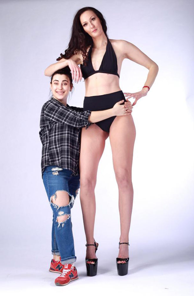 VĐV chân dài nhất thế giới 1m33, đô cử cụt tứ chi gây bão mạng 2017 - 2