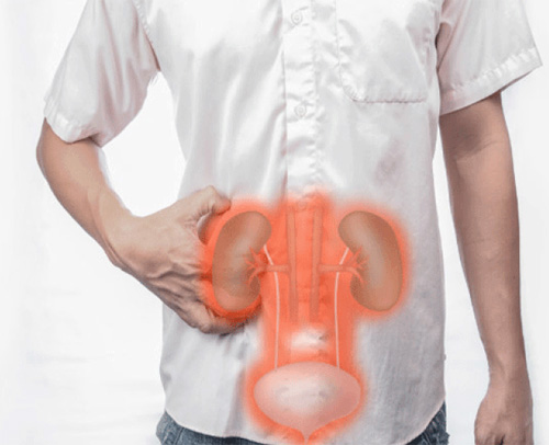 Đi tiểu trên 2 lần/đêm - dấu hiệu cảnh báo ung thư bàng quang - 2