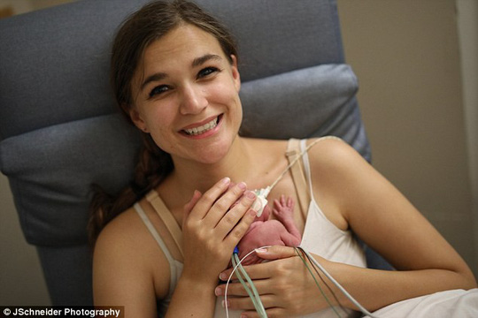 Bị sinh non trước 4 tháng, bé gái nhỏ như lon Coca - 3