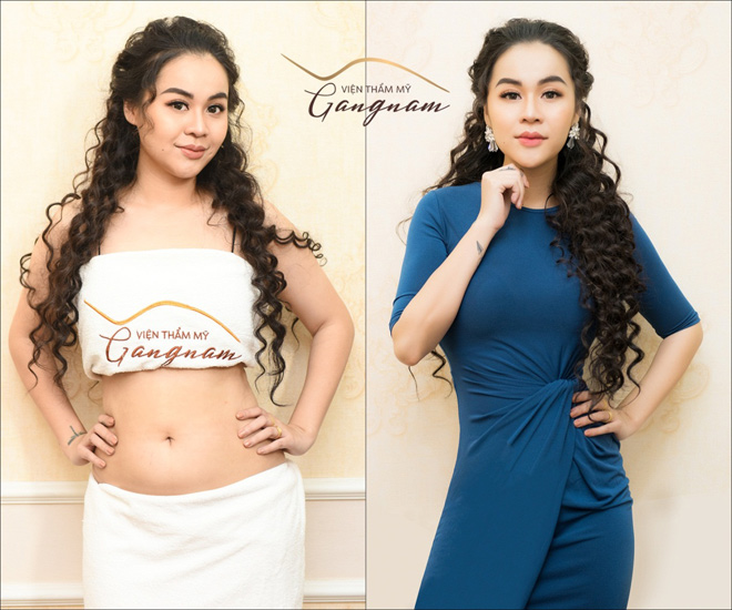 "Bão" ưu đãi cho siêu phẩm giảm béo từ thẩm mỹ viện của đại gia Hàn Quốc - 3