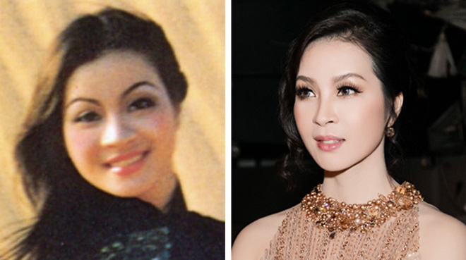 Chồng “soái ca” đưa vợ đi tân trang nhan sắc - 2