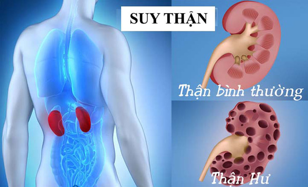 Cảnh báo nguy cơ suy thận khi đi tiểu đêm nhiều lần - 1